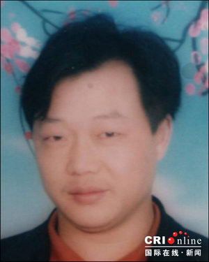 世界罕见缺骨面人造脸术将在四医大进行(组图)