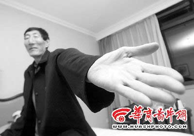 世界第一巨人出手取海豚胃中异物(图)