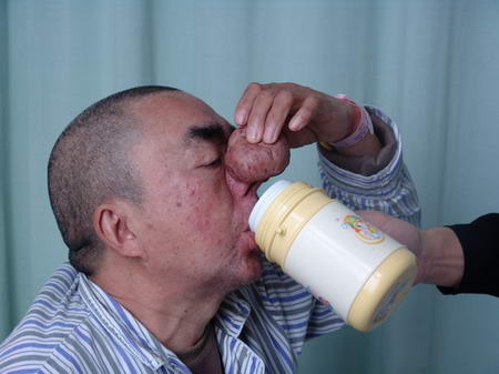 ѮϺƱǴ(ͼ)