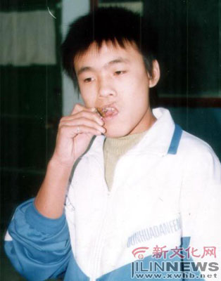 吉利16岁男孩吃灯泡上瘾 半月吃掉22只(图)