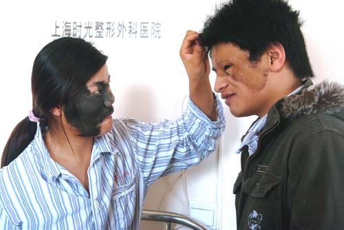 2006年12月19日上午,一位来自新疆霍城县的20岁女孩张幸(化名)因也患有“阴阳脸”来沪整形。张幸跟小吴在讨论手术。版权作品,请勿转载