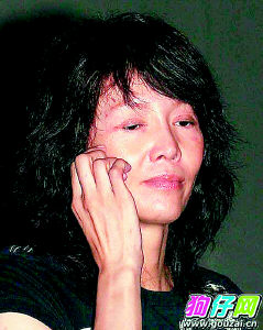 50岁郑裕玲为保青春频繁“换肤” 脸部皮肉松弛吓人(图)