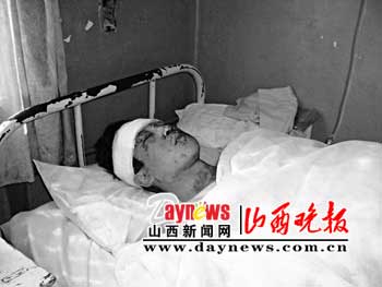 民宅清晨突发两次爆炸致一死六伤(图)