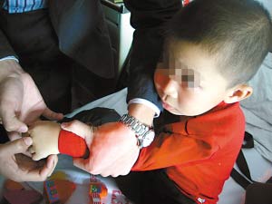 女老师持大钢勺敲幼儿头被开除(组图)