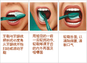 正确的刷牙时间和刷牙方法 正确的刷牙时间和刷牙方法