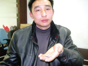 男子爱吃玻璃刀片 轻松嚼碎喝水咽下(图)
