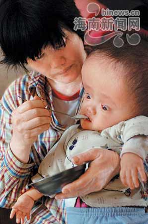 一岁婴儿患怪病脑袋比成人大(组图)