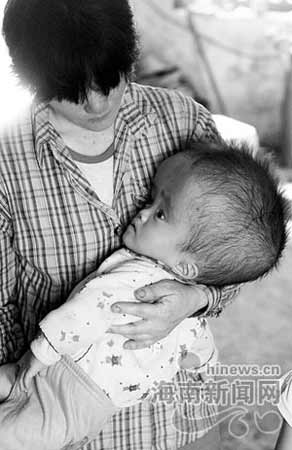 一岁婴儿患怪病脑袋比成人大(组图)