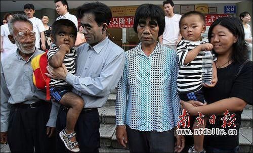 深圳一医院医疗专家组专程将“毛孩”文才,和同样“长毛”的爷爷、爸爸、姑姑接到深圳,开始免费进行长期外形和心理救助治疗。记者 何俊摄