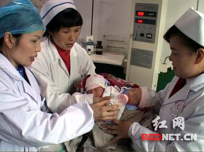 湖南产妇生连体女婴 腹臂相连共用一根脐带