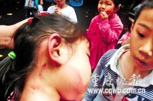 摇摇的耳朵、脸上有明显伤痕。记者 冉文 摄