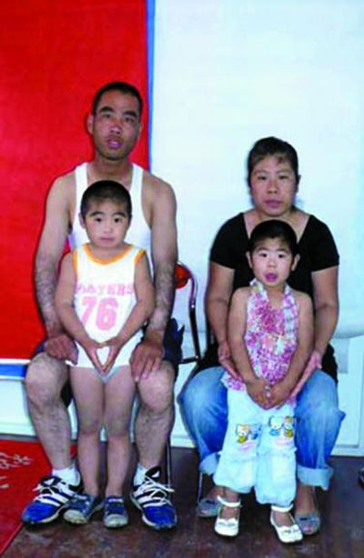 哈尔滨出现毛人家族 两代人体毛长六七厘米