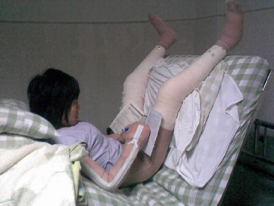 美女教师烧伤不成人形 战胜病痛重回讲台(图)
