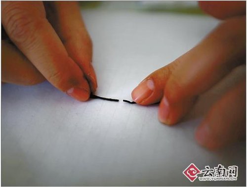 男子脑内插钢针50年没感觉 从未头痛过