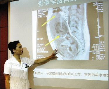 昨日,医生介绍王芳的核磁共振影像.本报记者 刘迅 摄