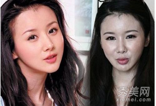 10位美女自找整容变蛇精脸失败罪受腿翘臀v美女女星长图片