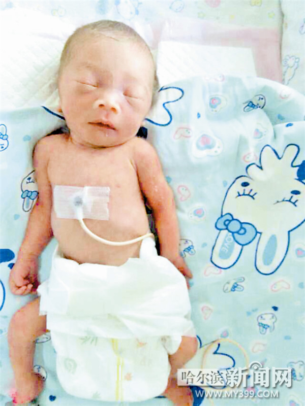 2斤重女婴裸身被弃垃圾箱续:母亲担心费用弃婴