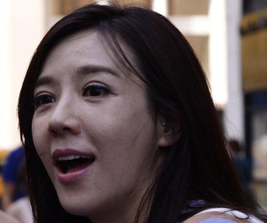 周韦彤眼部现手术刀痕 面瘫坑洞多疑整形过度