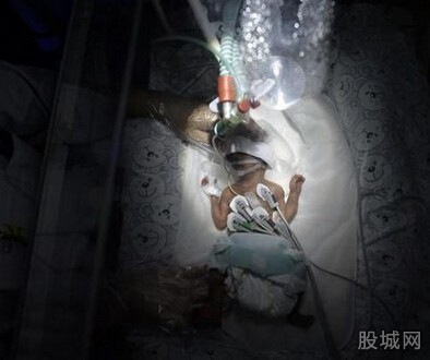 中国最小早产婴离世 中国最小早产婴离世 突来