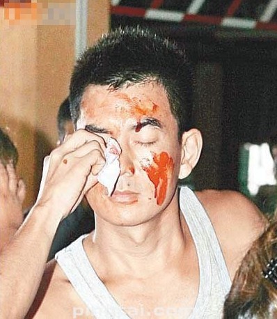 刘德华张柏芝唐嫣谢霆锋 盘点明星伤病事件(图