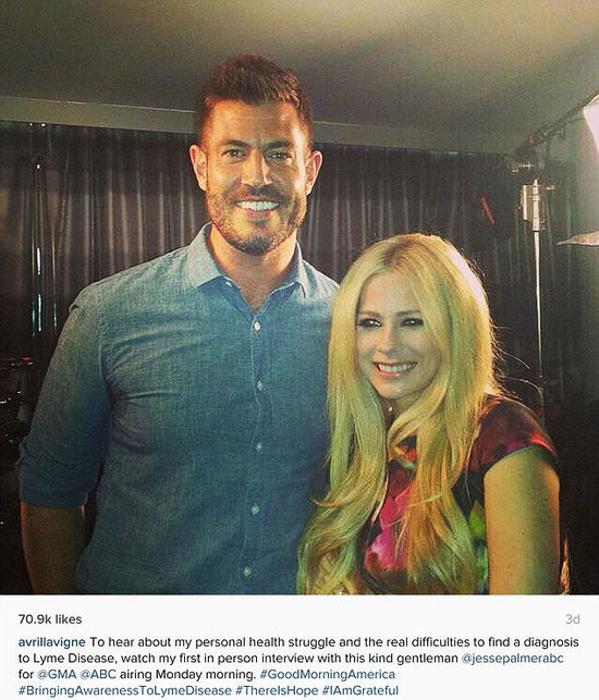 艾薇儿患莱姆症 能治好吗症状是什么-艾薇儿确