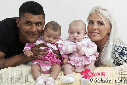 黑白配夫妇生下黑白双胞胎 百万分之一概率成