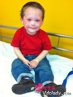 5岁男孩严重过敏 生日愿望竟是求死?-5岁男孩