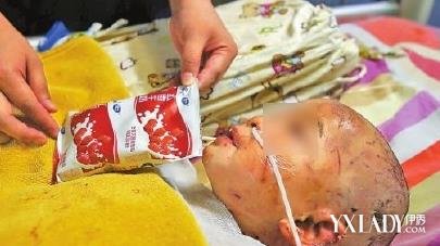 【图】女童遭10余条恶狗撕咬 狗主人不愿担责