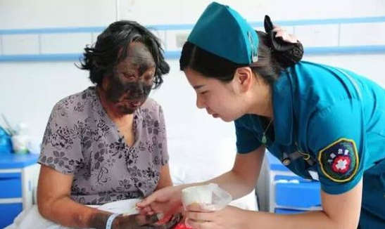 老太食用苋菜后晒日光过敏 脸色漆黑痛苦不堪