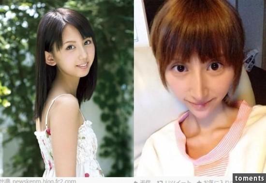 14个明星失败整形美女,其中一个让我吓傻了杭州街案例图片