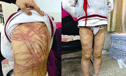 <em>南京虐童案</em> 受害男童及父母状告发帖人已获立