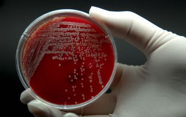  广州 地铁现 超级细菌 可致命  超级细菌 是怎样产