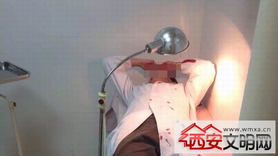  急诊医生被殴打  医生未与行凶者发生冲突--东北