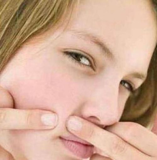 小伙 挤痘引发脑膜炎  三天内高烧至昏迷--东北网