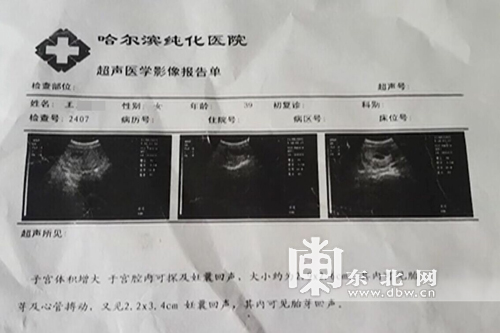 许诺 近日,哈尔滨市民王女士向东北网反映,她于2015年11月意外怀孕