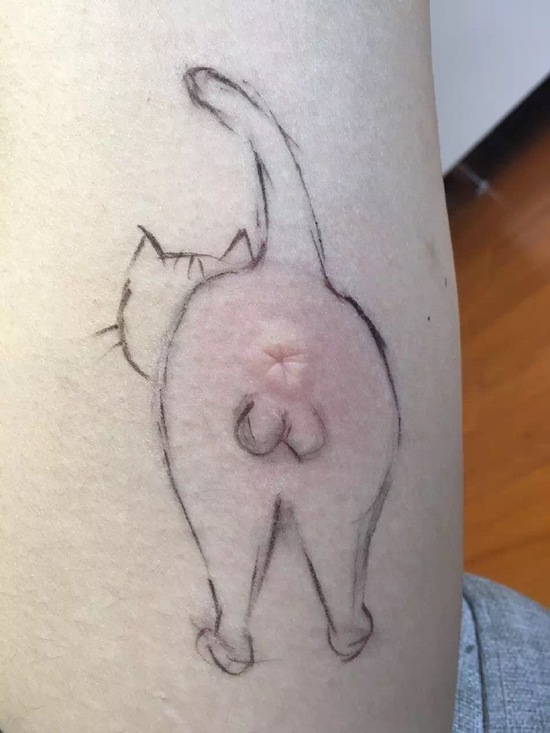 这位网友被蚊子咬了，然后在肿包上画了一只猫...