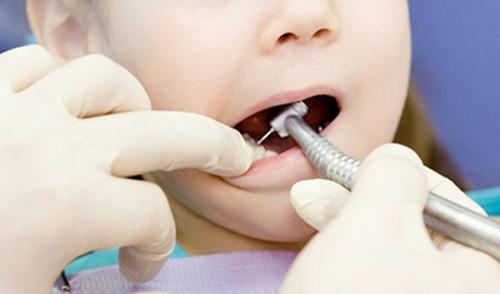 女童喝夜奶不刷牙 妙龄竟有一口老烟枪黑牙!