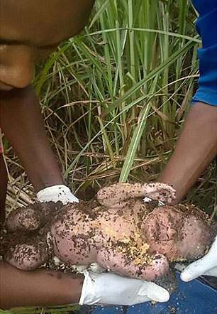 南非一婴儿被妈妈狠心活埋 3日后被救出仍存活