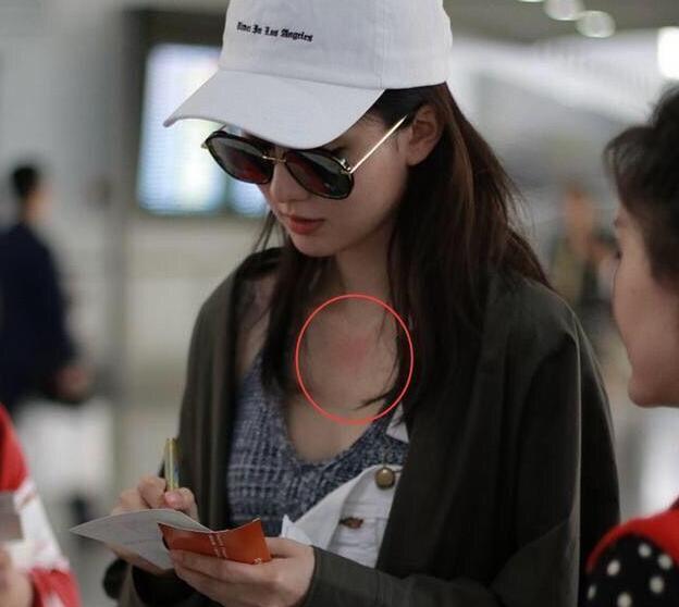 关关 乔欣胸前现红斑 网友:被种草莓了?