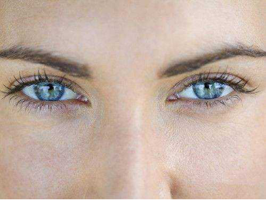 开眼角的价格贵吗 00300682081_42cf8f49.png