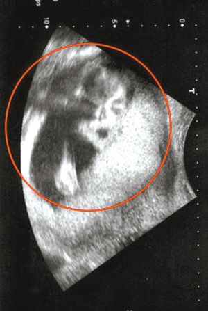 孕12周男宝b超图图片