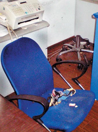 椅子液压杆爆炸受伤图片