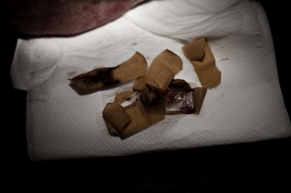 德国变性人的辛酸妓女生活