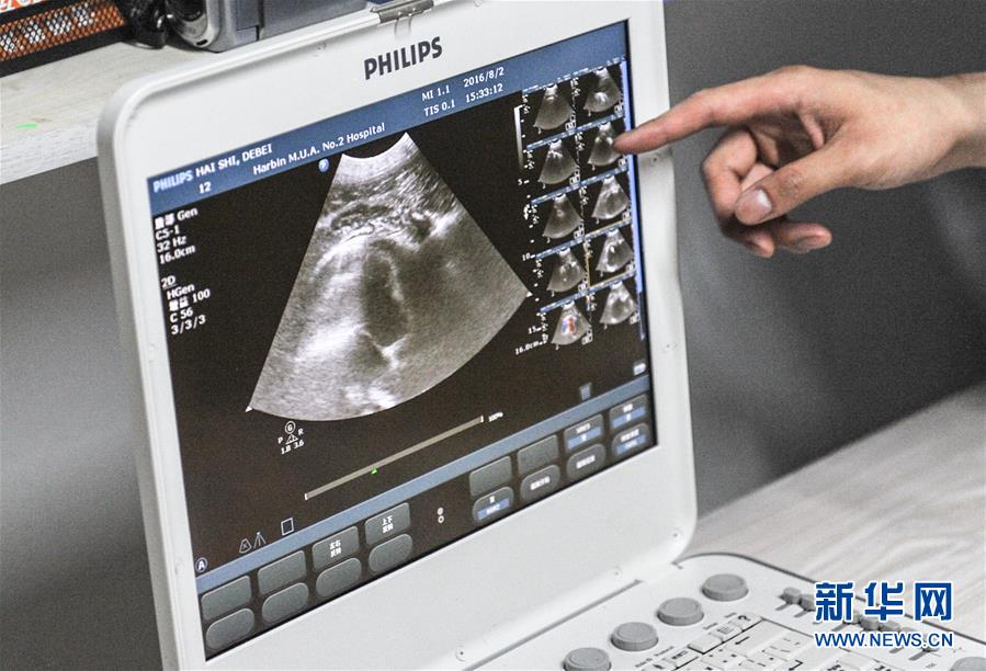 孕22周男孩睾丸b超图图片
