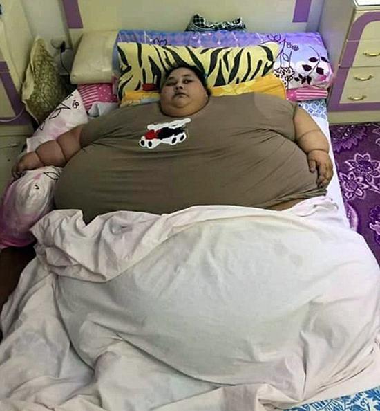 世界最胖女性26天减240斤:曾被起重机吊起送医