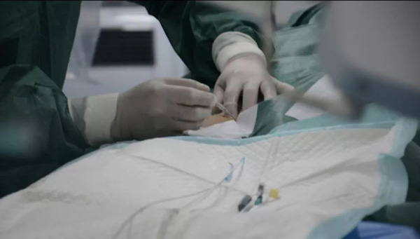 身体状况很脆弱,在当地医生的建议下,管先生采用膀胱造瘘方式放置尿管